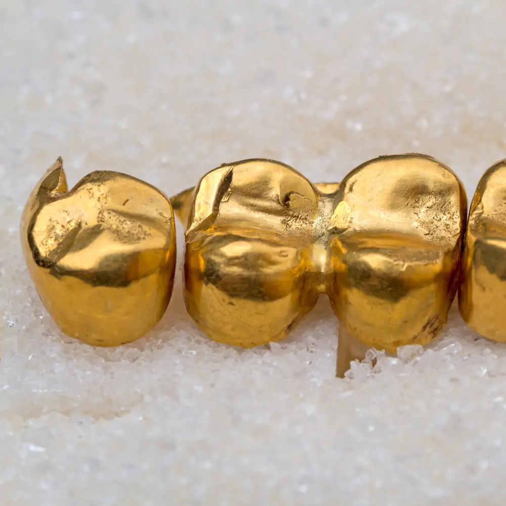 Zahngold Ankauf bei der Goldwaage